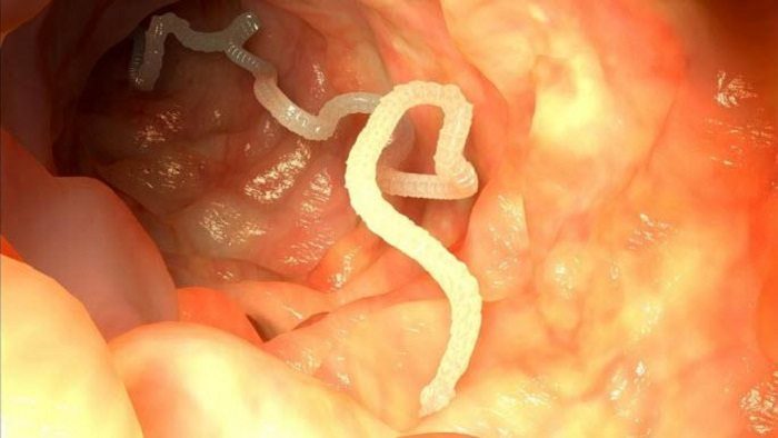 Глисты и паразиты в кишечнике у человека: симптомы, виды и методы лечения и очищения
